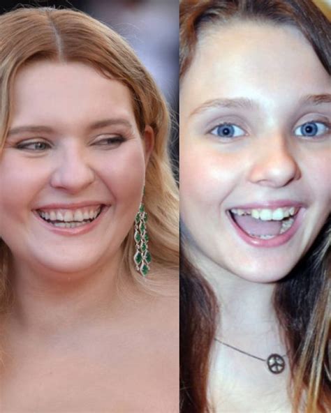 abigail breslin teeth|Abigail Breslin Transformation: See Little Miss